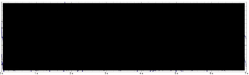 Image of stored electrogram, slightly redacted.